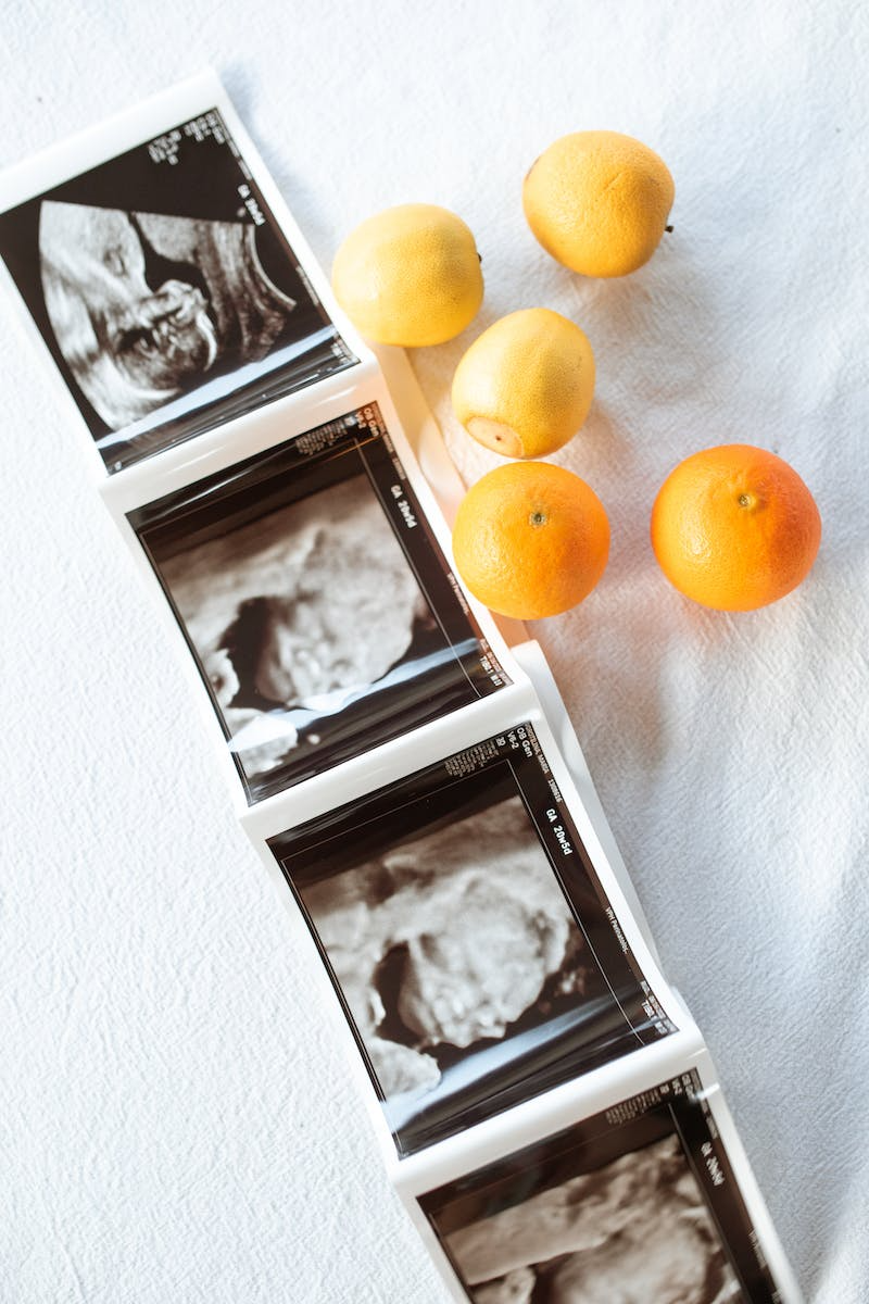 What to Expect During Ultrasound During Pregnancy, Purpose, and Results